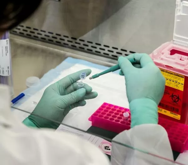 CDC scientist prepares biopsy sample for molecular testing in laboratory