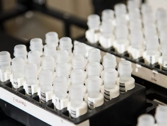 A tray of small plastic test tubes