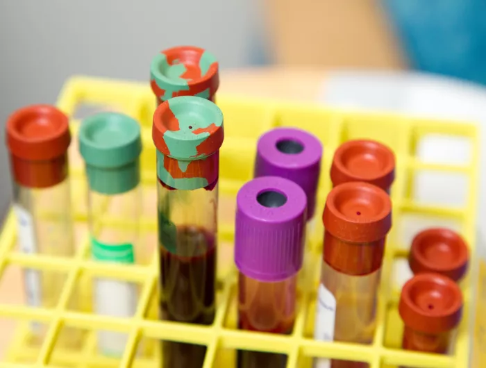 Test tubes filled with blood